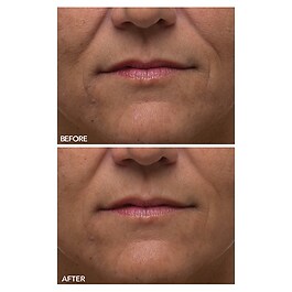 Alpha Beta® - Ultramildes Peeling für den Alltag